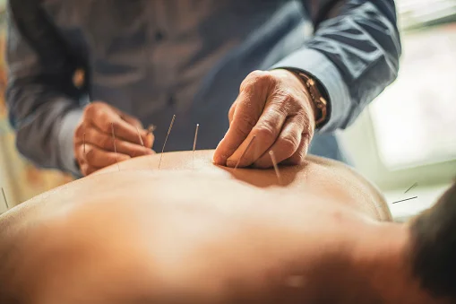 Acupuncture Helps with Morning Sickness