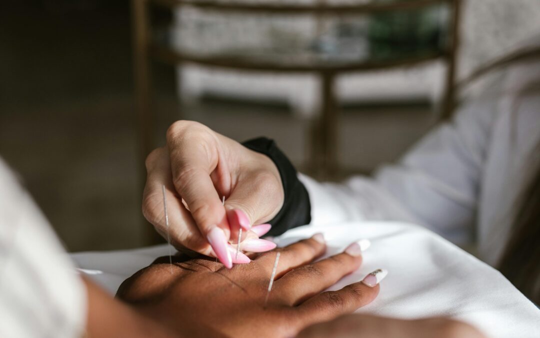 Acupuncture Kitchener