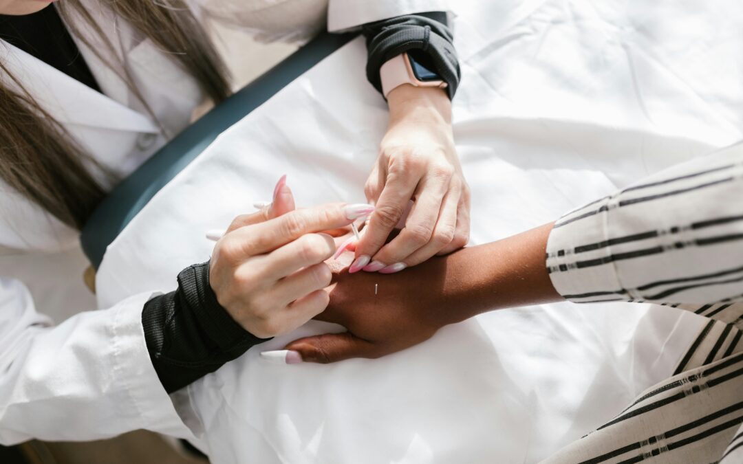 Benefits of Acupuncture for Pain Management in Kitchener