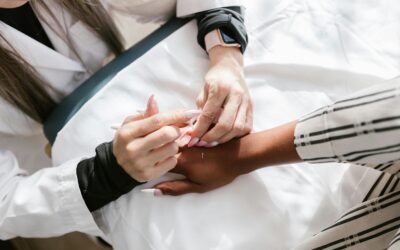 Benefits of Acupuncture for Pain Management in Kitchener