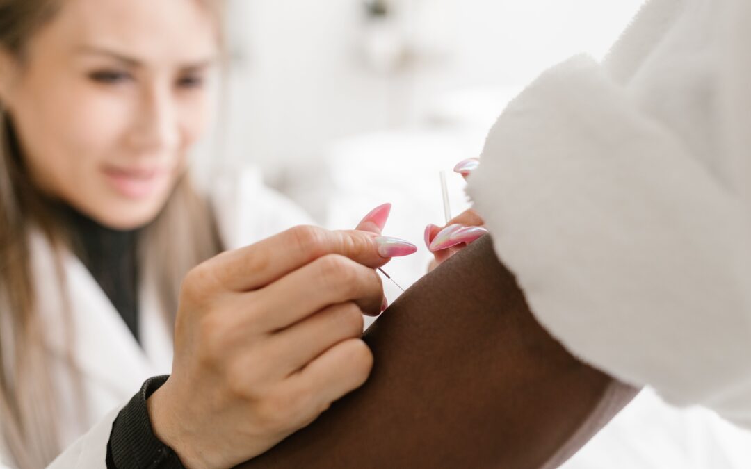 Acupuncture Kitchener