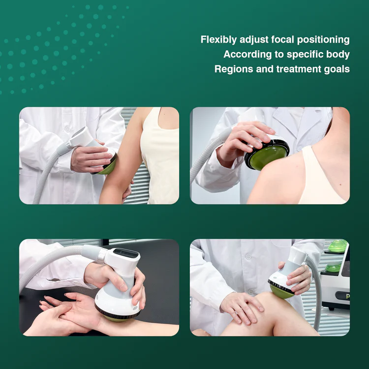 Shockwave Therapy Kitchener